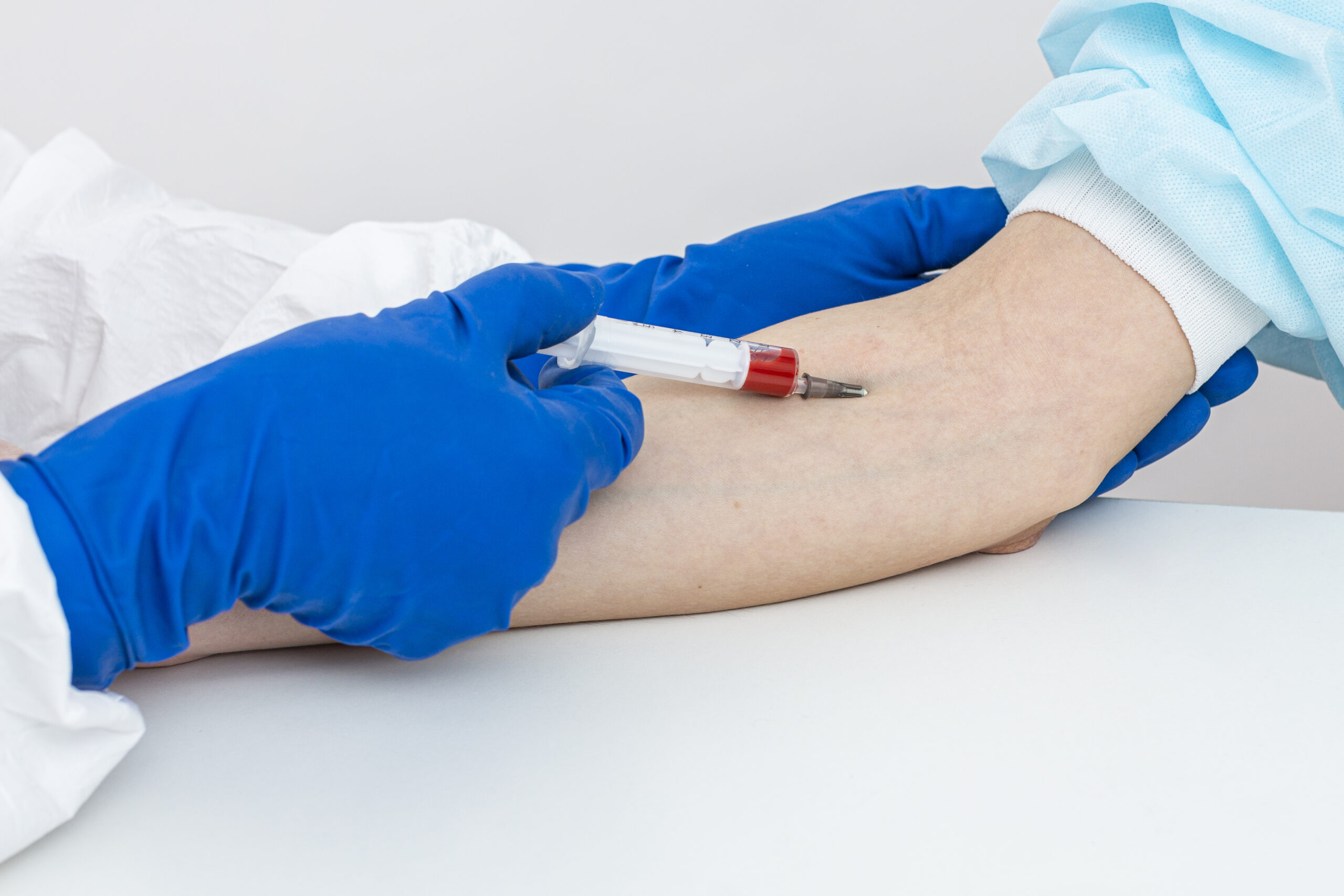 Tips for Pediatric Blood Collection